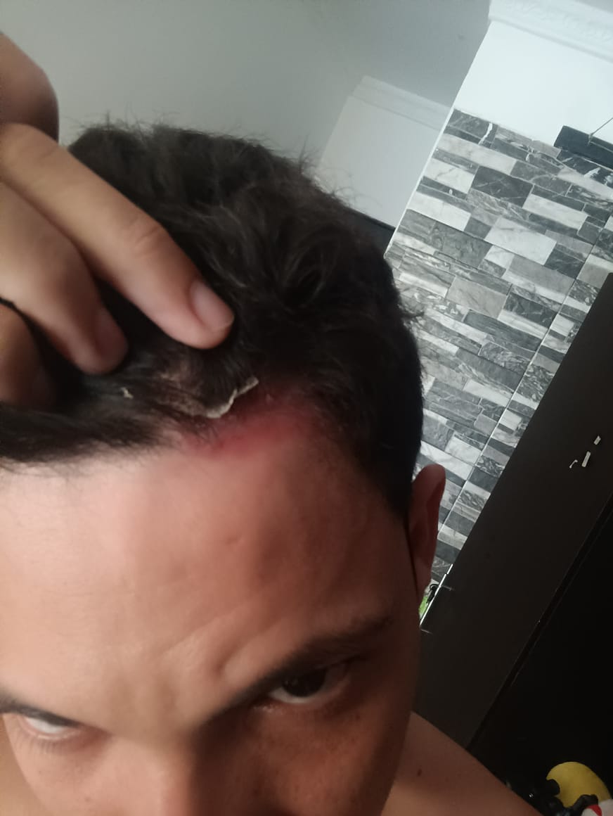 Imagen del antes